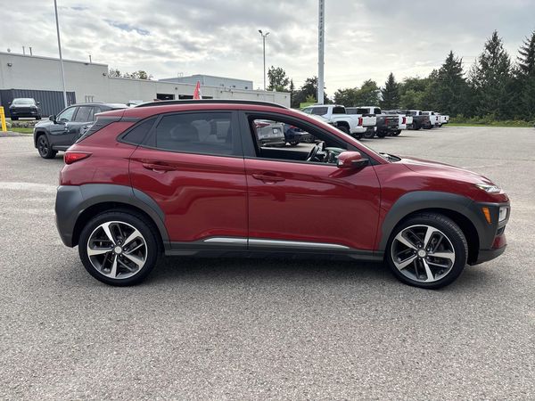 2020 Hyundai Kona Ultimate