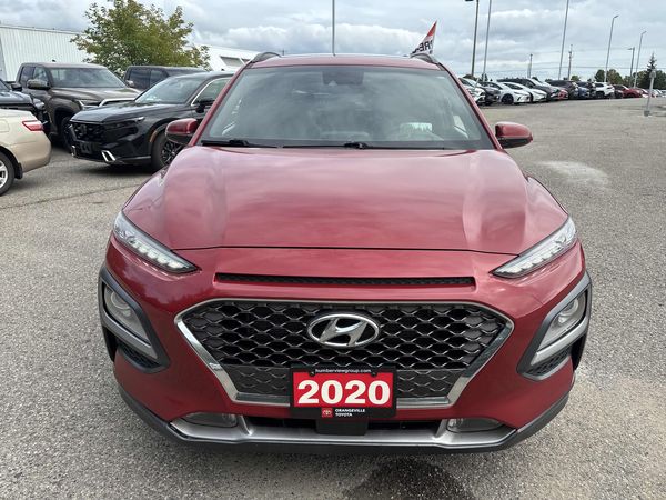 2020 Hyundai Kona Ultimate
