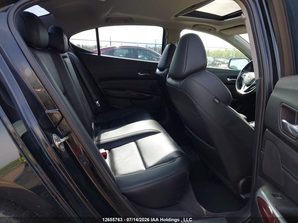 2017 ACURA TLX TECH