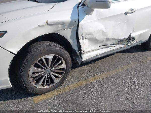 2016 ACURA RDX Advance Package