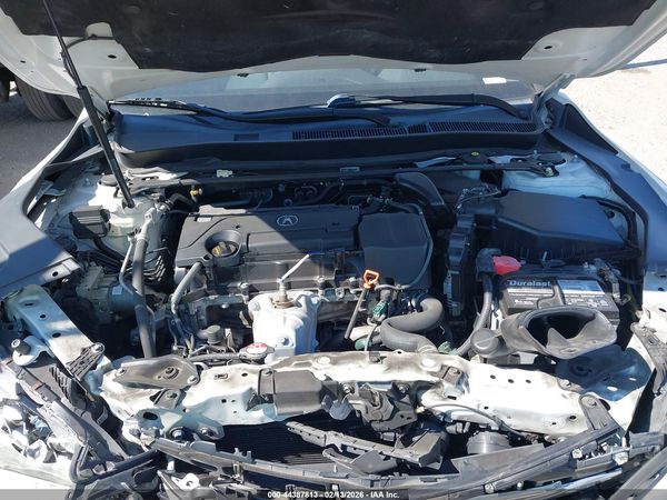 2017 ACURA TLX TECHNOLOGY PACKAGE