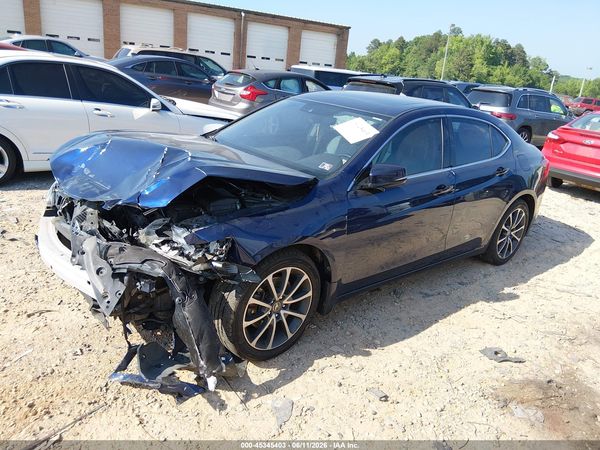 2017 ACURA TLX TECHNOLOGY PACKAGE