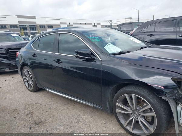 2020 ACURA TLX TECH PACKAGE