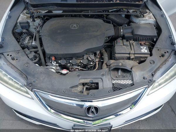 2017 ACURA TLX TECHNOLOGY PACKAGE