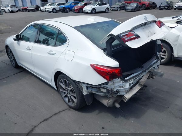 2017 ACURA TLX TECHNOLOGY PACKAGE