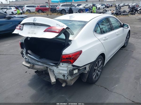 2017 ACURA TLX TECHNOLOGY PACKAGE