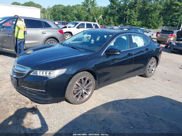 2017 ACURA TLX TECHNOLOGY PACKAGE