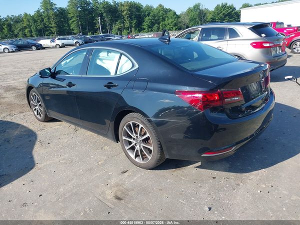 2017 ACURA TLX TECHNOLOGY PACKAGE