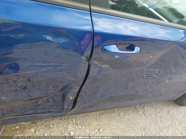 2023 KIA FORTE LXS — I155