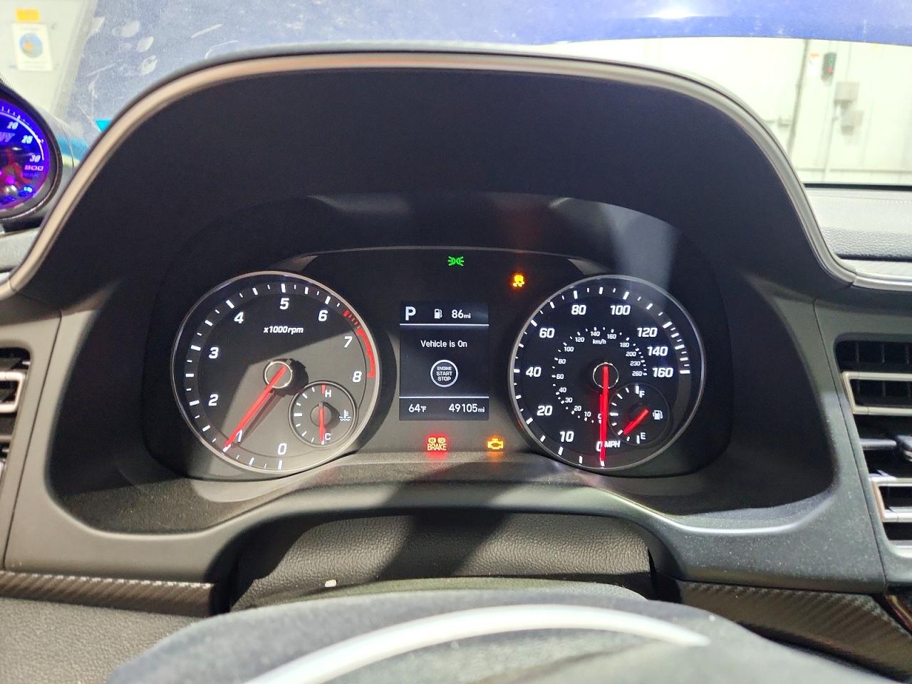 2020 HYUNDAI ELANTRA Sport