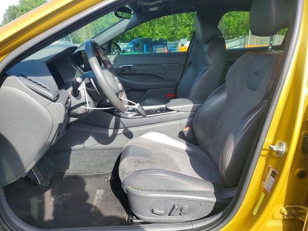 2021 HYUNDAI SONATA N Line — DENT