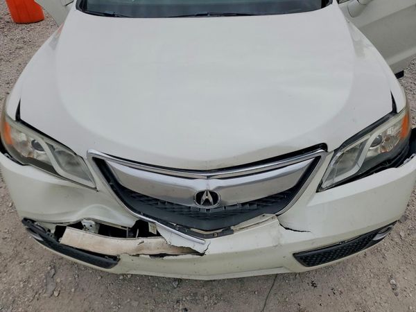 2015 ACURA RDX Technology Package