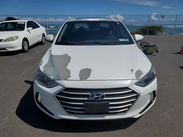 2017 HYUNDAI ELANTRA
