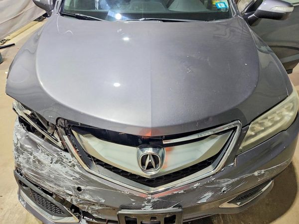 2017 ACURA RDX Advance Package