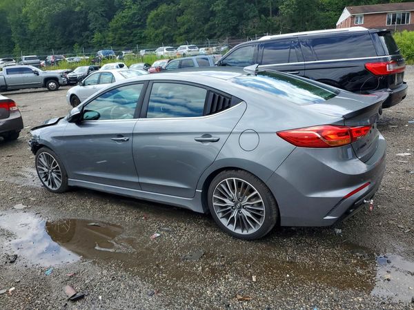 2017 HYUNDAI ELANTRA