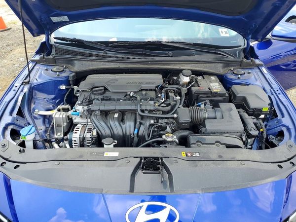 2025 HYUNDAI ELANTRA SEL Convenience — Engine bay