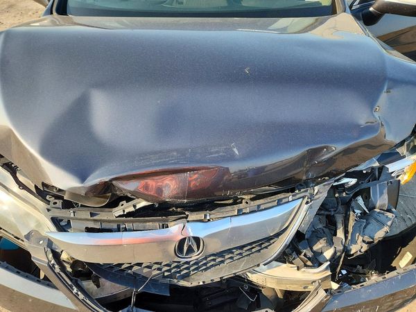 2015 ACURA RDX Technology Package