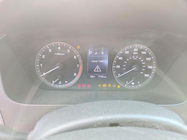 2017 HYUNDAI SONATA — ODOM