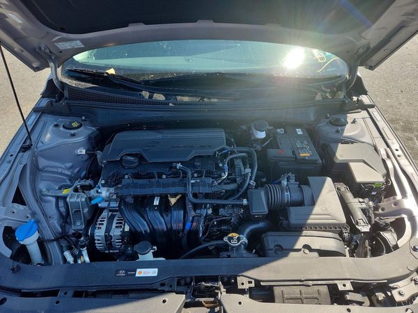 2025 HYUNDAI ELANTRA SEL Convenience — Engine bay
