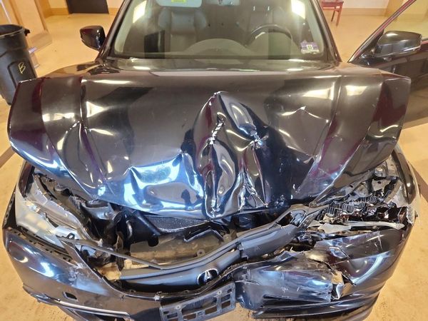 2015 ACURA TLX