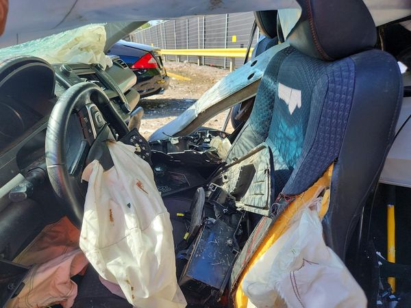 2015 TOYOTA CAMRY — DENT