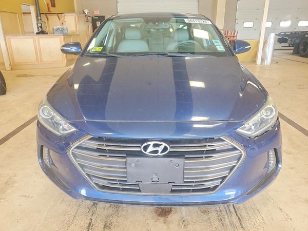 2017 HYUNDAI ELANTRA