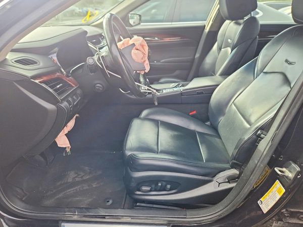 2014 CADILLAC CTS — DENT
