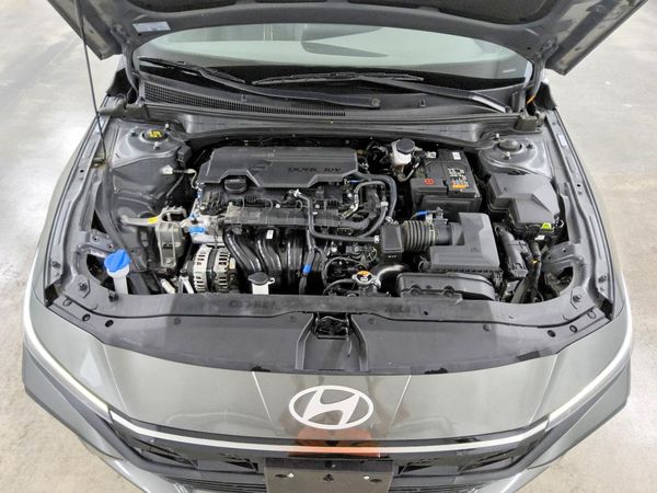 2025 HYUNDAI ELANTRA SEL Convenience — Engine bay