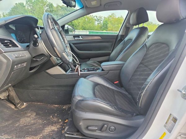 2015 HYUNDAI SONATA — DENT