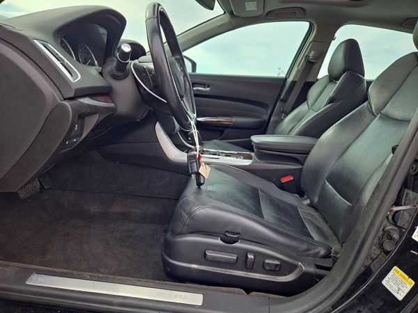 2016 ACURA TLX TECH — DENT