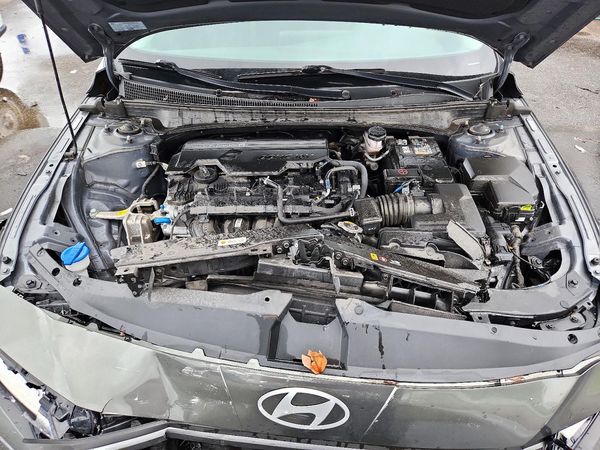 2025 HYUNDAI ELANTRA SE — Engine bay