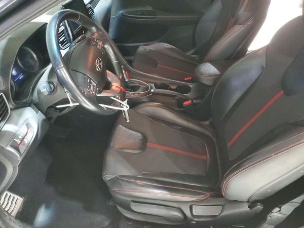 2019 HYUNDAI VELOSTER — DENT